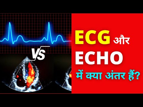 Video: Kada se radi ehokardiogram?