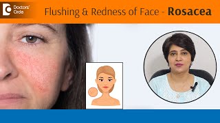 When to be worried about Skin Flushing?|Blushing|Flushed Face|Rosacea-Dr.Rasya Dixit|Doctors' Circle