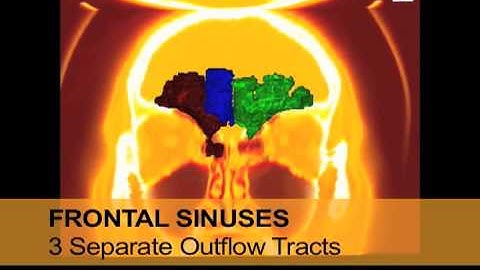 OsiriX - In-Office evaluation of your sinuses.mov