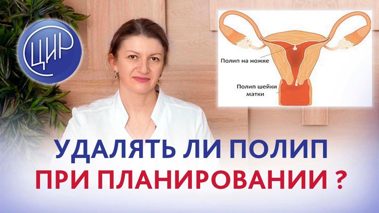 Секс После Удаления Полипа Секс После Удаления Полипа