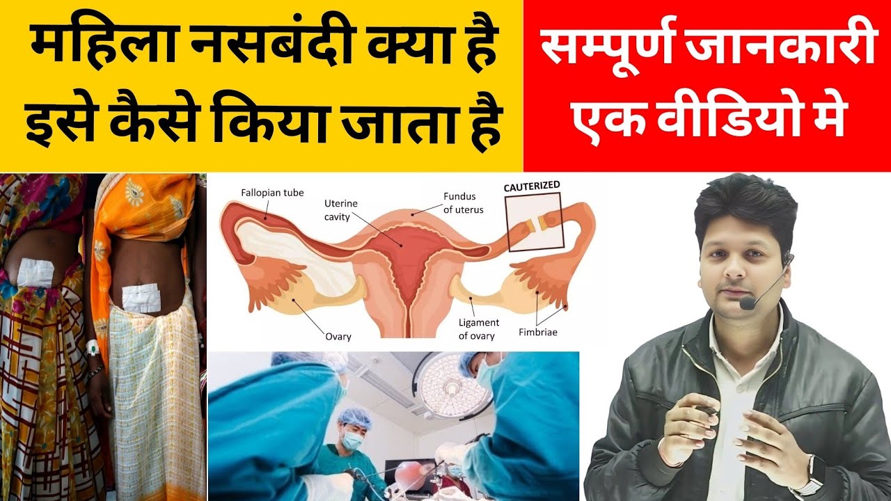 बच्चा बंद होने का ऑपरेशन कैसे होता है | tubectomy operation | mahila nasbandi | tubectomy
