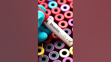 Review Article: Measles 2025