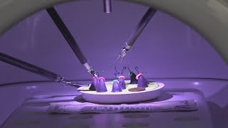 St. Joseph Hospital introduces new robotic surgery device, lending surgeons helping hands