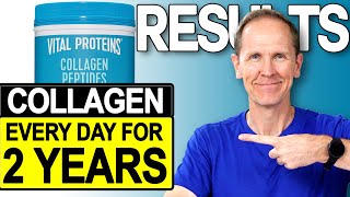 Vital Proteins Collagen Peptides | Results After 2 Years