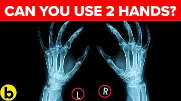 Which twin is usually dominant?