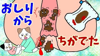 【アニメ絵本 読み聞かせ】恥ずかしいけどお尻の病院へ行ってみた絵本〜痔の絵本〜おしりから血が出た〜