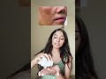Why Glutone-A Beats Regular Glutathione Every Time