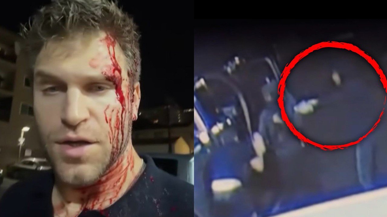 'Pretty Little Liars' Star Bloodied In West Hollywood Attack
