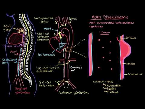 Aort Diseksiyonu Nedir? (Fen Bilimleri) (Sağlık ve Tıp)