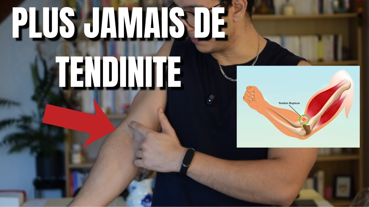 Les 4 conseils méconnus pour des tendons en acier.