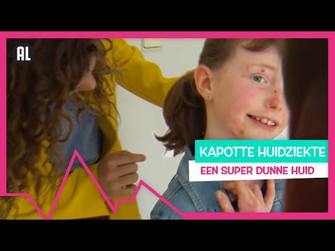 Video: Waarom verliest mijn kat haar haar?