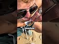 Toxic Sea Creatures Attack Man On Beach