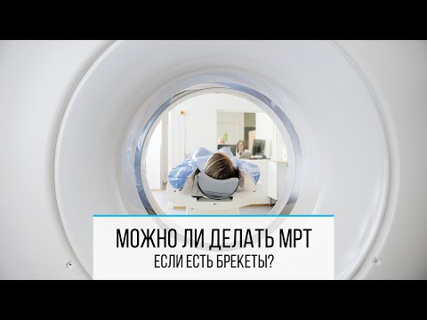 МОЖНО ЛИ ДЕЛАТЬ МРТ С БРЕКЕТАМИ? ОТВЕЧАЕТ ОРТОДОНТ