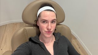 I Got A Laser Facial Bbl Moxi New Skin Here I Come