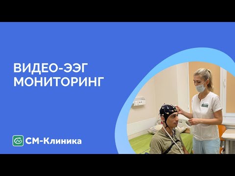 Видео-ЭЭГ мониторинг для
