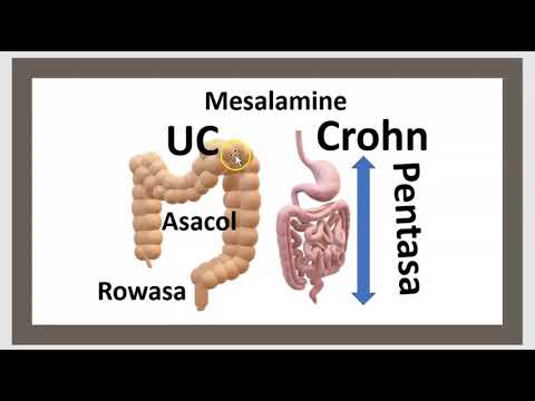 Vidéo: Stricture Intestinale Dans La Maladie De Crohn: Symptômes, Traitement Et Plus