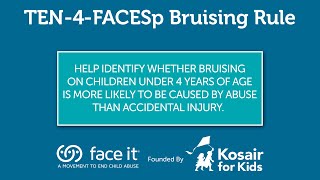 Ten-4-Facesp Bruising Rule Animated