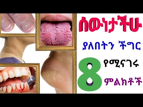 ቪዲዮ: የ Evgenia Gapchinskaya ያደጉ መላእክት። መቶ በመቶ አዎንታዊ