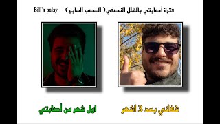 رحلتي مع مرض العصب السابع - صورت نفسي من اول يوم الى يوم الشفاء، Bill's Palsy