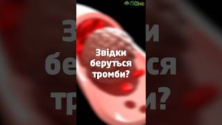 Звідки беруться тромби? Відповідає кардіолог #кардіолог #профілактика #тромбоз #тромб