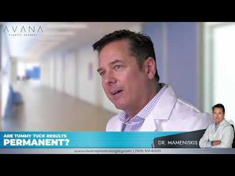 Are Tummy Tuck results permanent? - Dr. Mameniskis