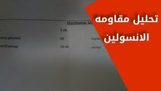 تحليل مقاومه الانسولين  HOMA test