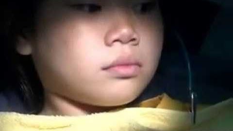 Hướng dẫn gắn Twinblock ngược trên lâm sàng   BS HOÀNG ĐỨC THÁI