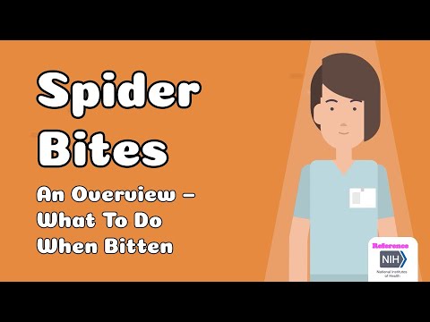 Spider bites - When to worry, Symptoms & First Aid