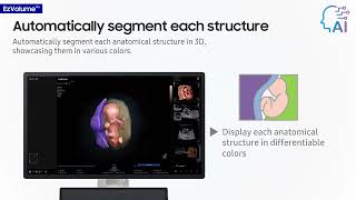 Obstetrics - Samsung Heraz20 Features