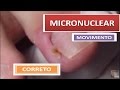 Movimento do micronuclear