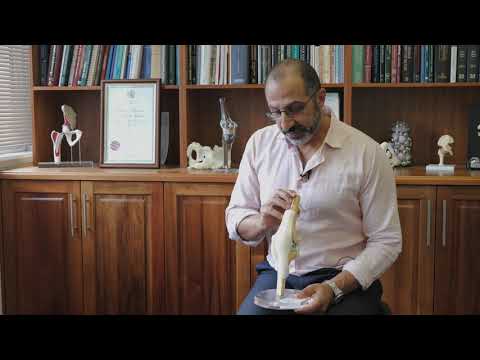 Knee Replacement Surgery explained by Dr. Elie Khoury - Orthopaedic Surgeon