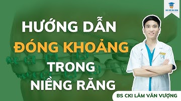 Hướng dẫn đóng khoảng trong niềng răng I Học Viện Nha Khoa Việt Nam I Bs Lâm Văn Vượng