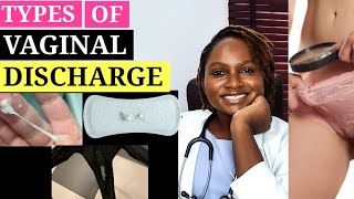 Types of Vaginal Discharge and what they mean // How Abnormal Discharge can Cause Infertility