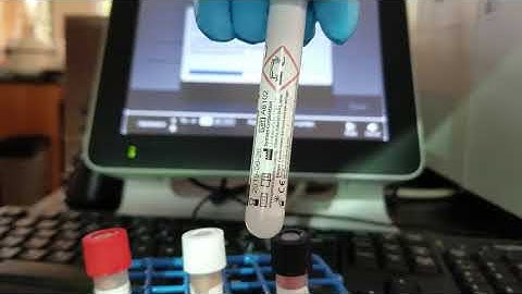 Hematology: Running Cell Clean Auto on the Sysmex XN-550 Analyzer