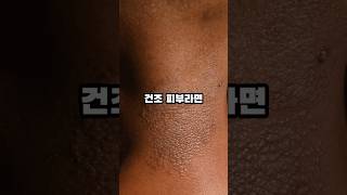 스킨보톡스????? #shorts