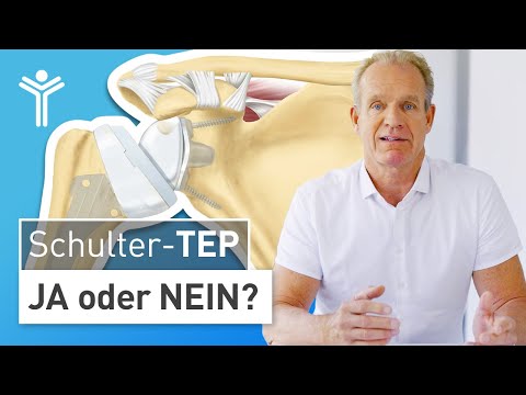 Schulterarthrose: Wann operieren?