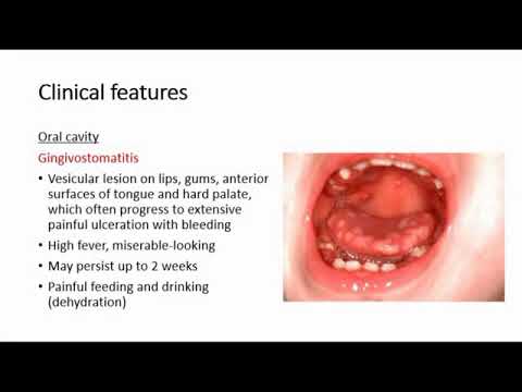 Cold Sores & Genital herpes awareness | Permanent Treatment - YouTube