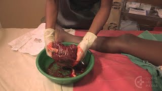 Examining the Placenta (Tamasheq) - Childbirth Series