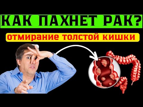 Video: Vulva оору - көп таралган себептери жана коштоочу симптомдору