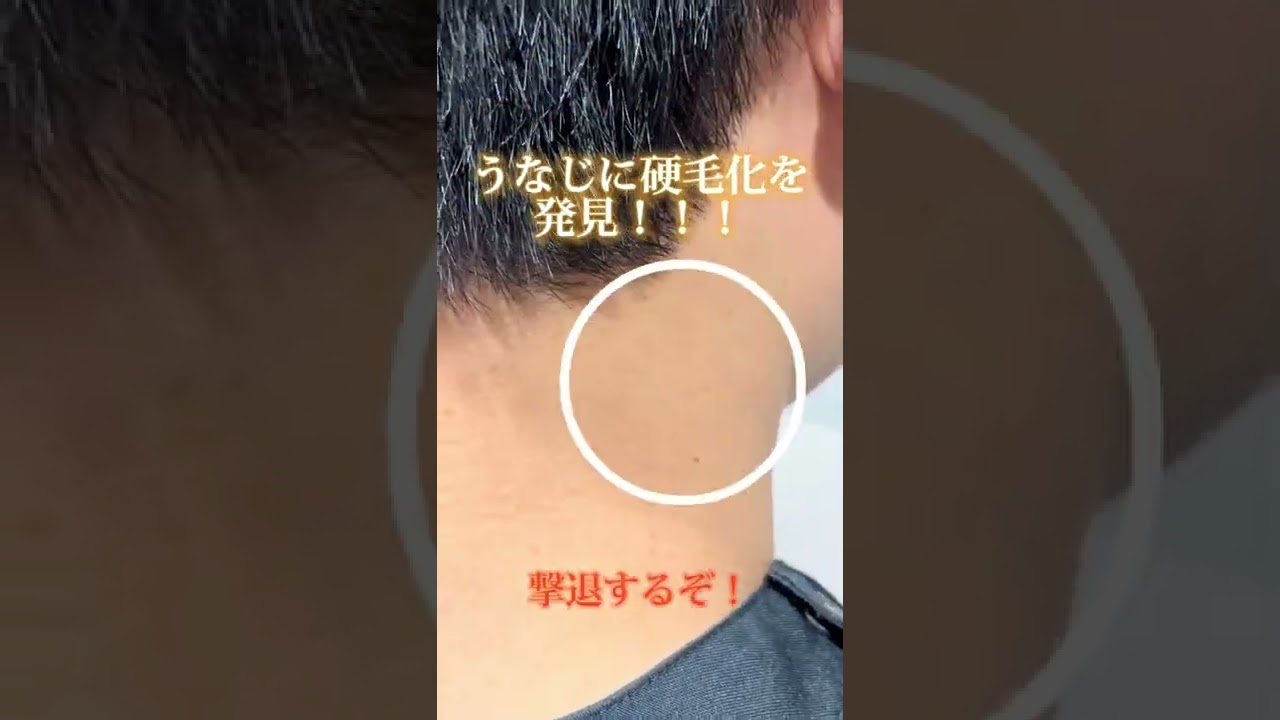 硬毛化とは 見分け方から考えられる原因と対策と治療法 レナトゥスクリニック東京田町新宿仙台院