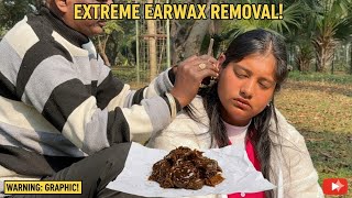 EXTREME HARD EARWAX CANAL CLEANING AND DEEP MIX OILLING OF AYURVEDA EARWAX CLEANING ASMR |