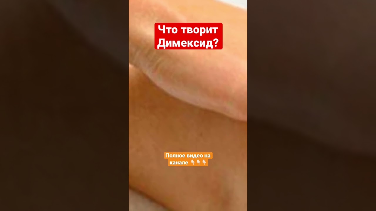 Что творит Димексид ?