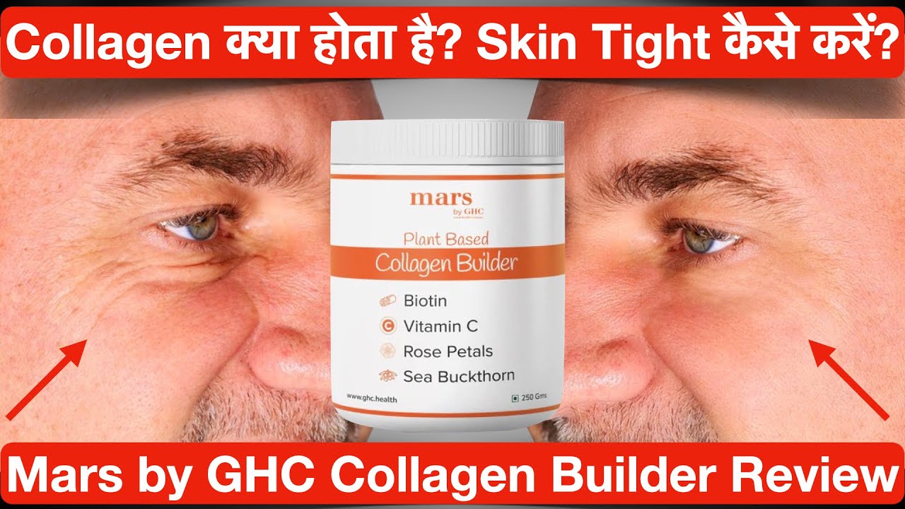 Collagen Kya hota hai? Collagen kaise badhaye? Mars by GHC Collagen
