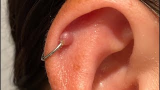 Why I took my helix piercing out