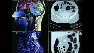 Tk Online Werbung 2004