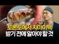 흡연으로 누렇게된 치아, 치아미백으로 해결 가능할까요?