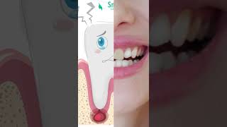 "Why does a tooth turn grey after experiencing trauma?"
