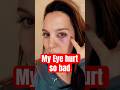 What Really Happened When a Metal Fragment Hit My Eye? #breakingnews