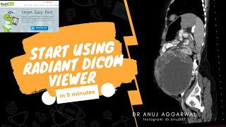 How to use RADIANT Dicom viewer? I Radiology Basics I Dr Anuj Aggarwal screenshot 1
