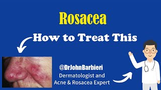Dermatologist explains rosacea causes and treatment in 8 minutes - @DrJohnBarbieri